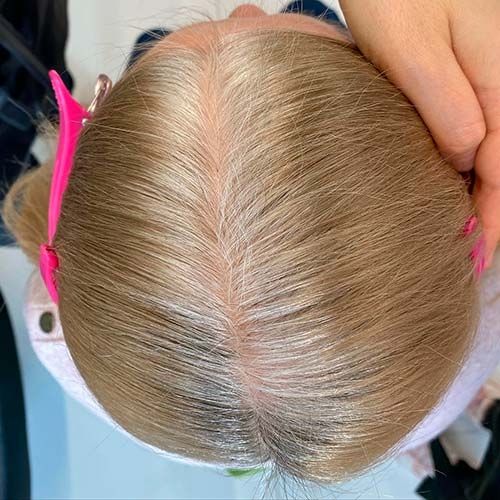 Седина до окрашивания